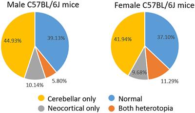 Neocortical and cerebellar malformations affect flurothyl-induced seizures in female C57BL/6J mice